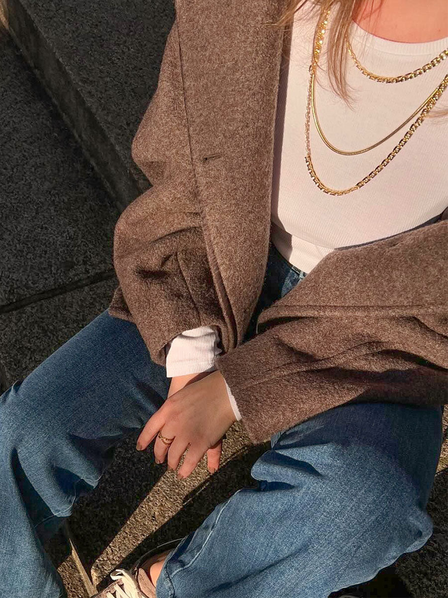 Elegant Watch Brand Bodychain